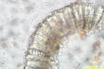<i>Lecidella elaeochroma</i>
