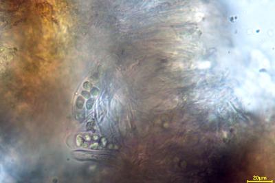 <i>Lecidella elaeochroma</i>