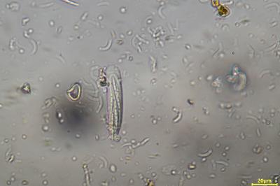 <i>Opegrapha vulgata</i>