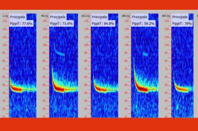 Pipistrelle commune
